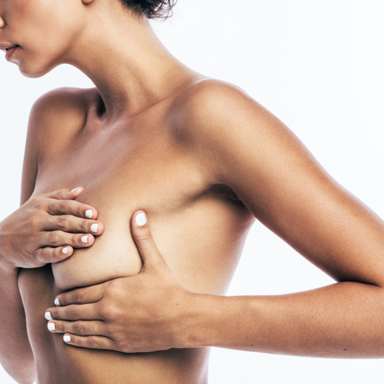 Picture of a woman using reverse pressure softening on her breast